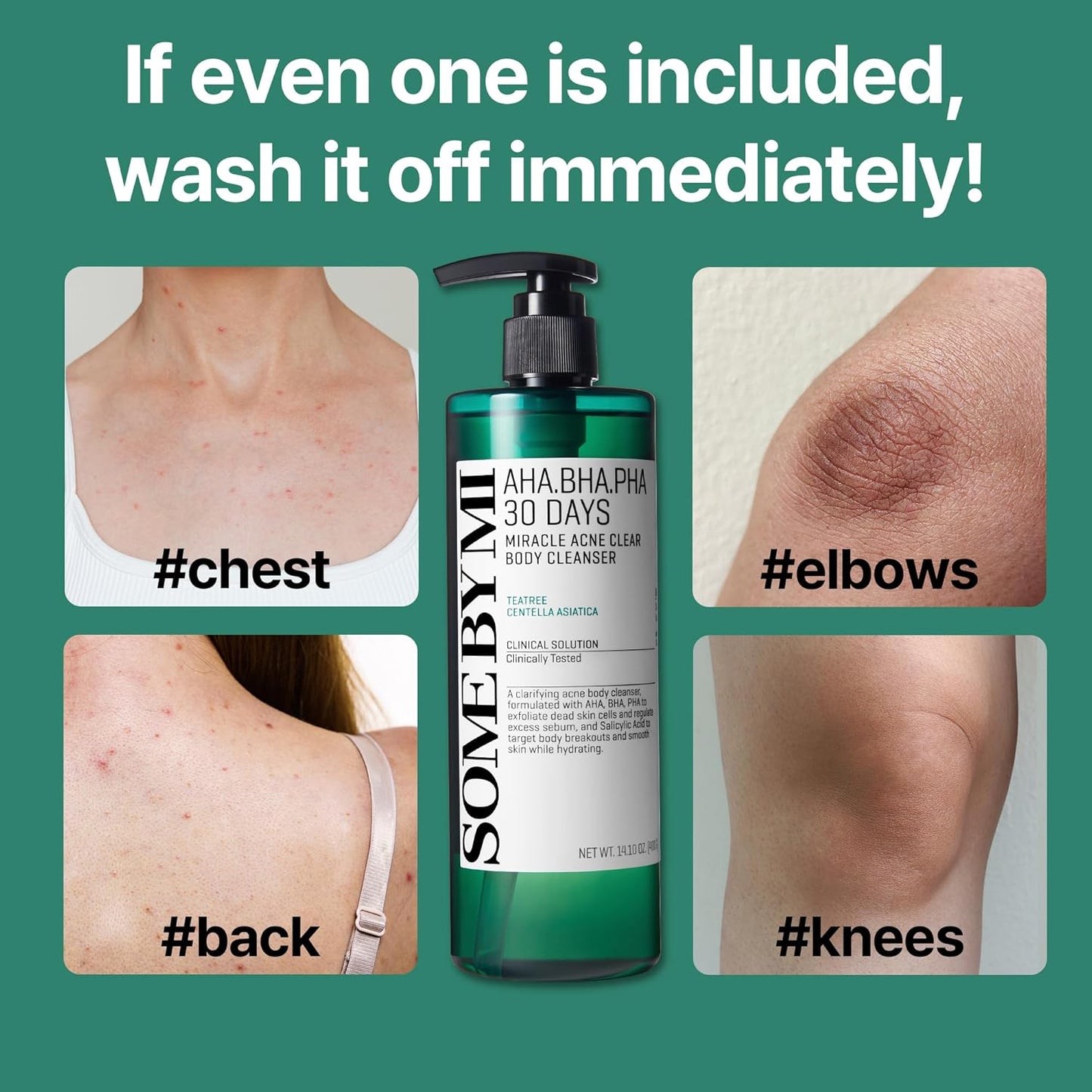 AHA.BHA.PHA 30 Days Miracle Acne Body Cleanser 150ml