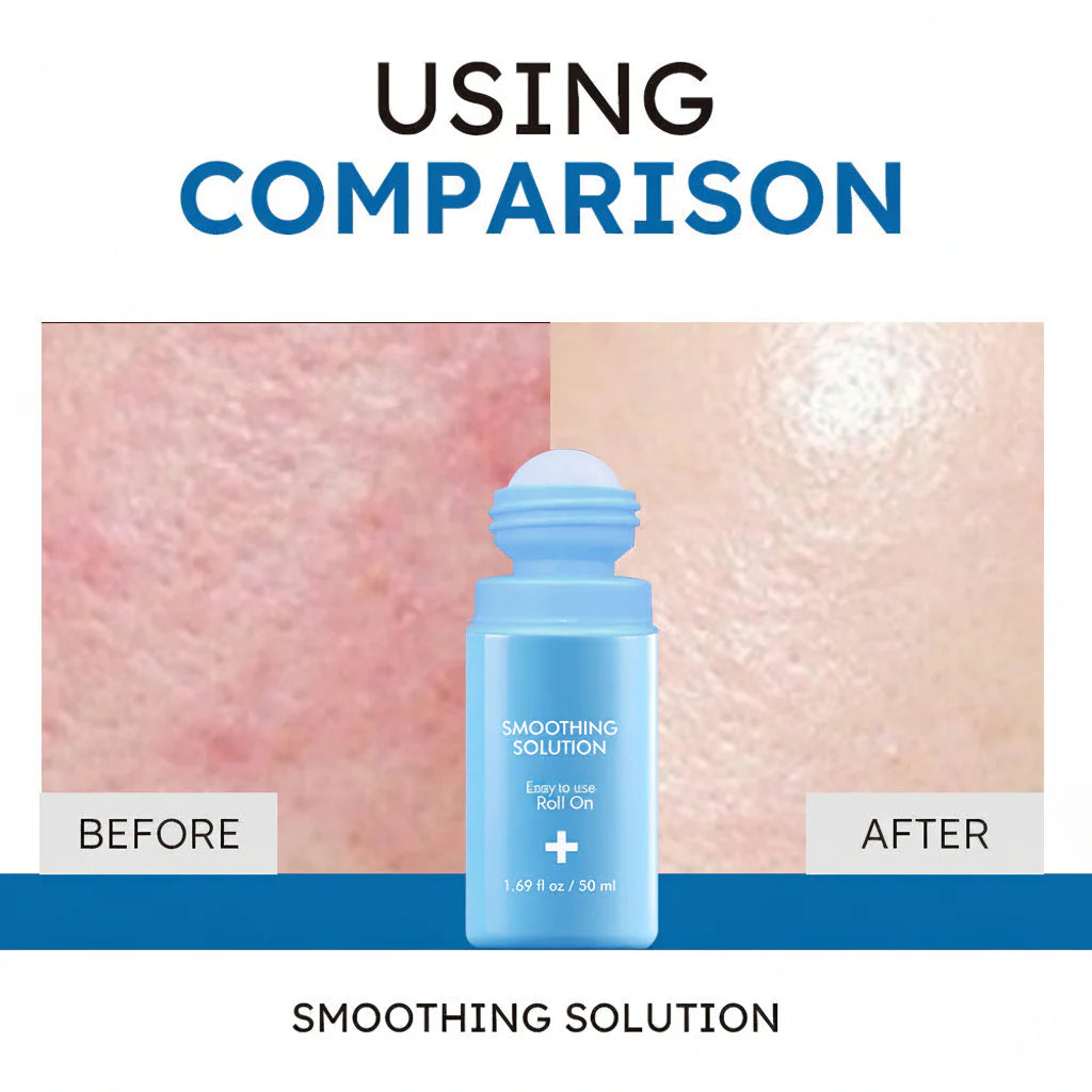 Ingrown Hair Treatment Roll-On - Smooth, Clear Skin Solution upsell