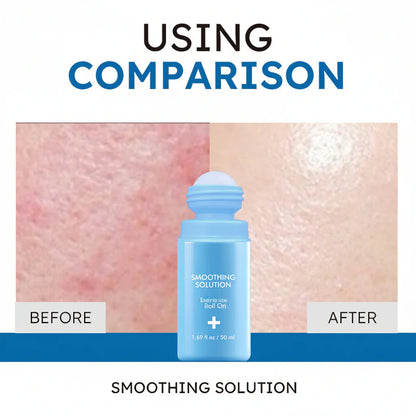Ingrown Hair Treatment Roll-On - Smooth, Clear Skin Solution upsell