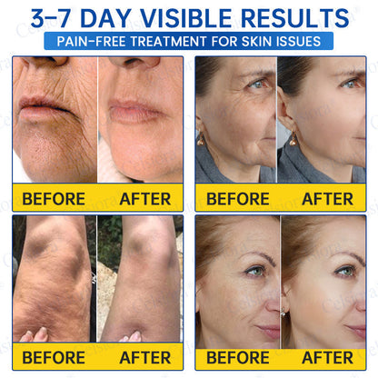 PDRN Advanced Firming & Renewal Cream